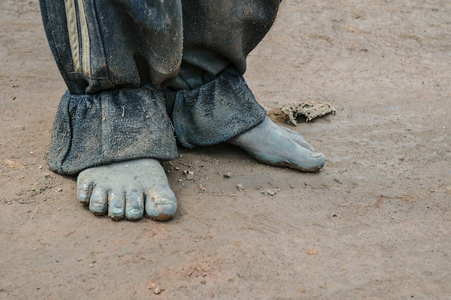 Photo Gospel, Poverty